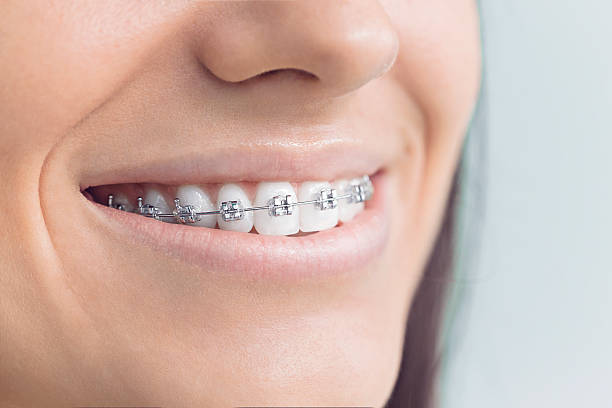 Best Traditional Braces  in Cascade, IA